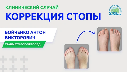 Деформация стопы: лечение и коррекция